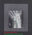 X-ray-roxanne-left-hand.jpg